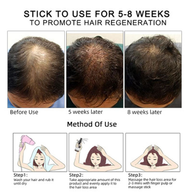 Hair growth  Essential Oil