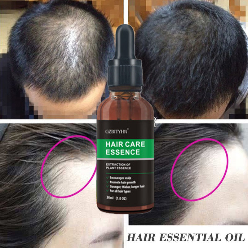 Hair growth  Essential Oil